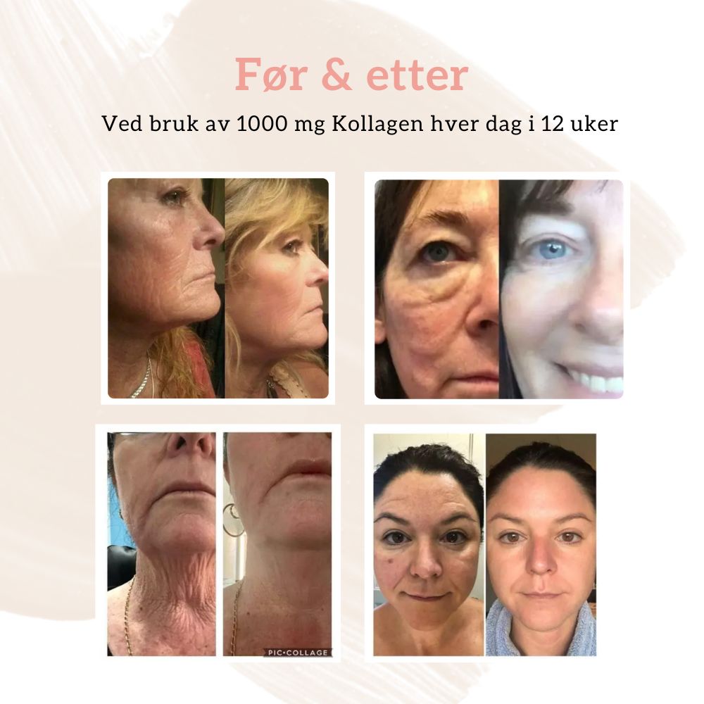 KOLLAGEN 2, HYALURONSYRE & FURUBARK Aarja Health